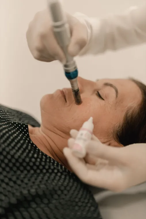 Faire un microneedling à Triel-sur-Seine, Triel-sur-Seine, SpaVana